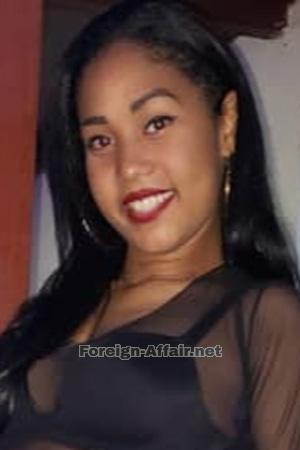 197109 - Doralis Age: 26 - Cuba